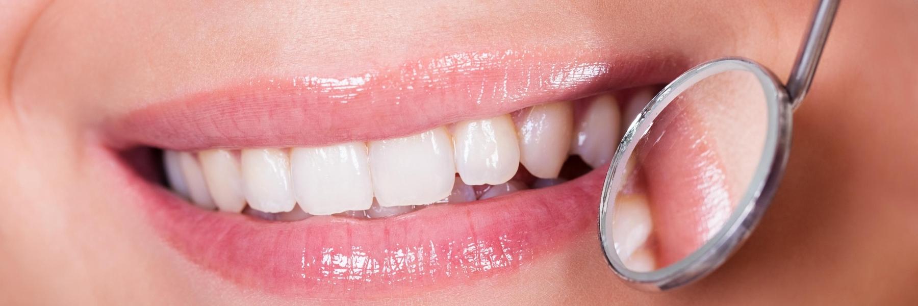 woman smiling with healthy gums in springfield mo